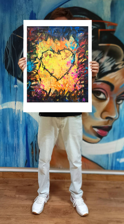 LOVE HURTS - NOMEN